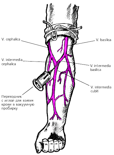 Венепункция локтевой вены. Расположение локтевой вены для забора крови. V. Intermedia cubiti, промежуточная Вена локтя.